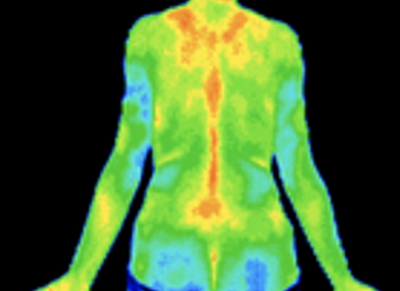 Thermography scan of spine and back area