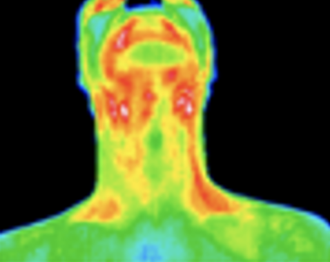 Thermography image of thyroid