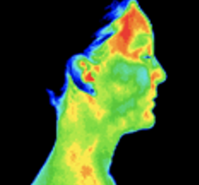 Thermography image of face, lateral view