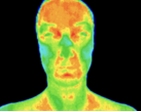 Thermography scan of sinus and forehead area