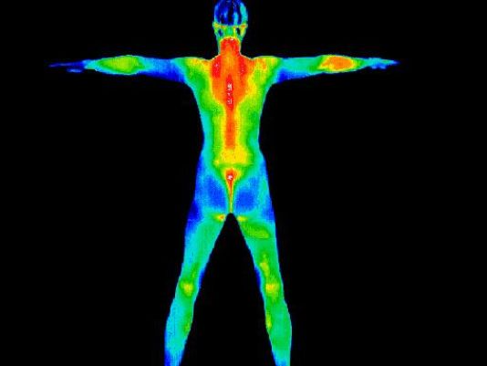 Full body thermography scan showing heat patterns