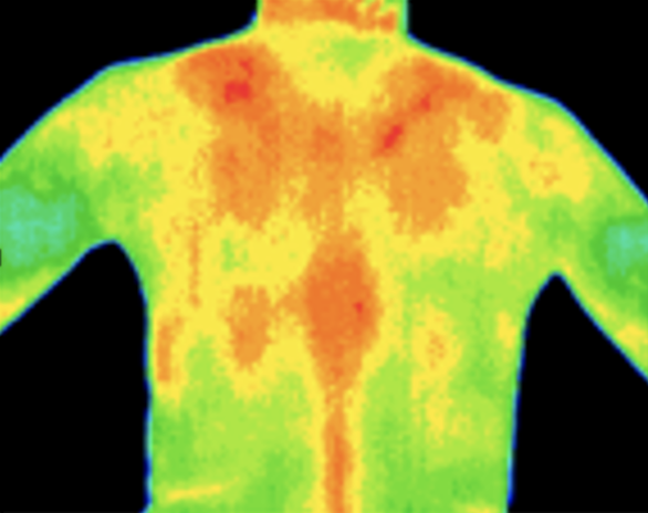 Thermography image of shoulders