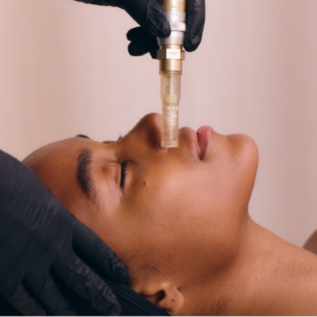 Nano-needling  Treatment