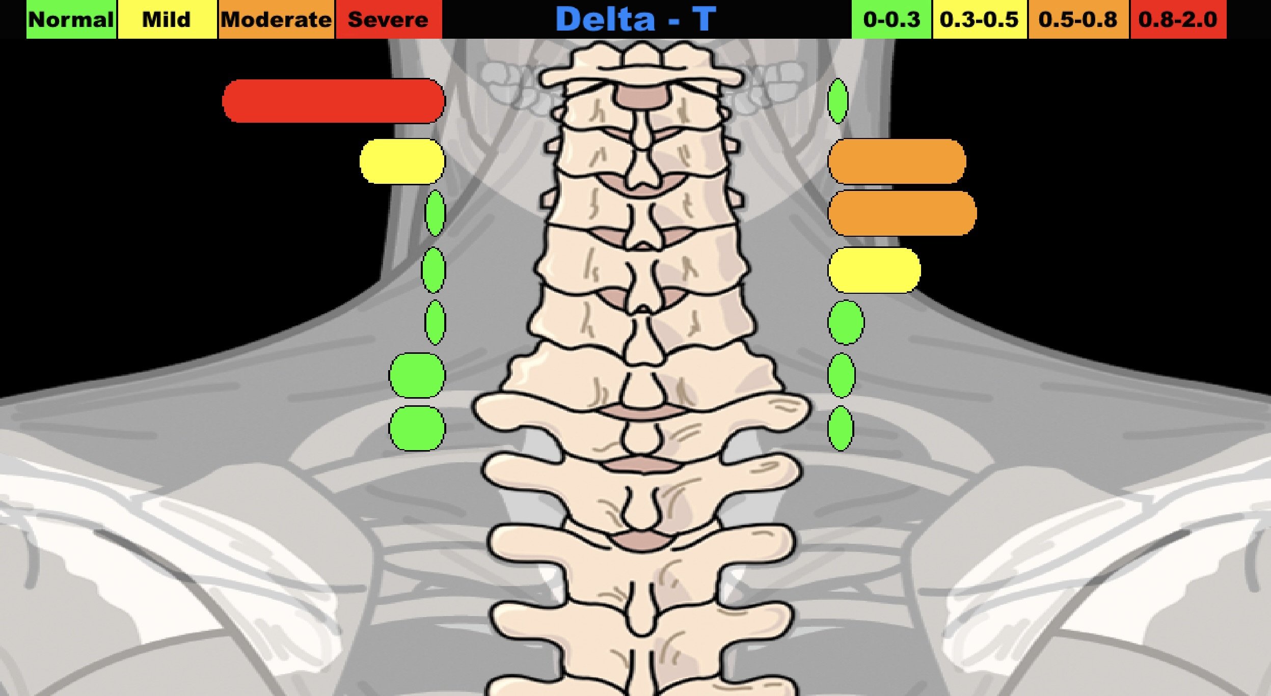 Tytron thermography scan