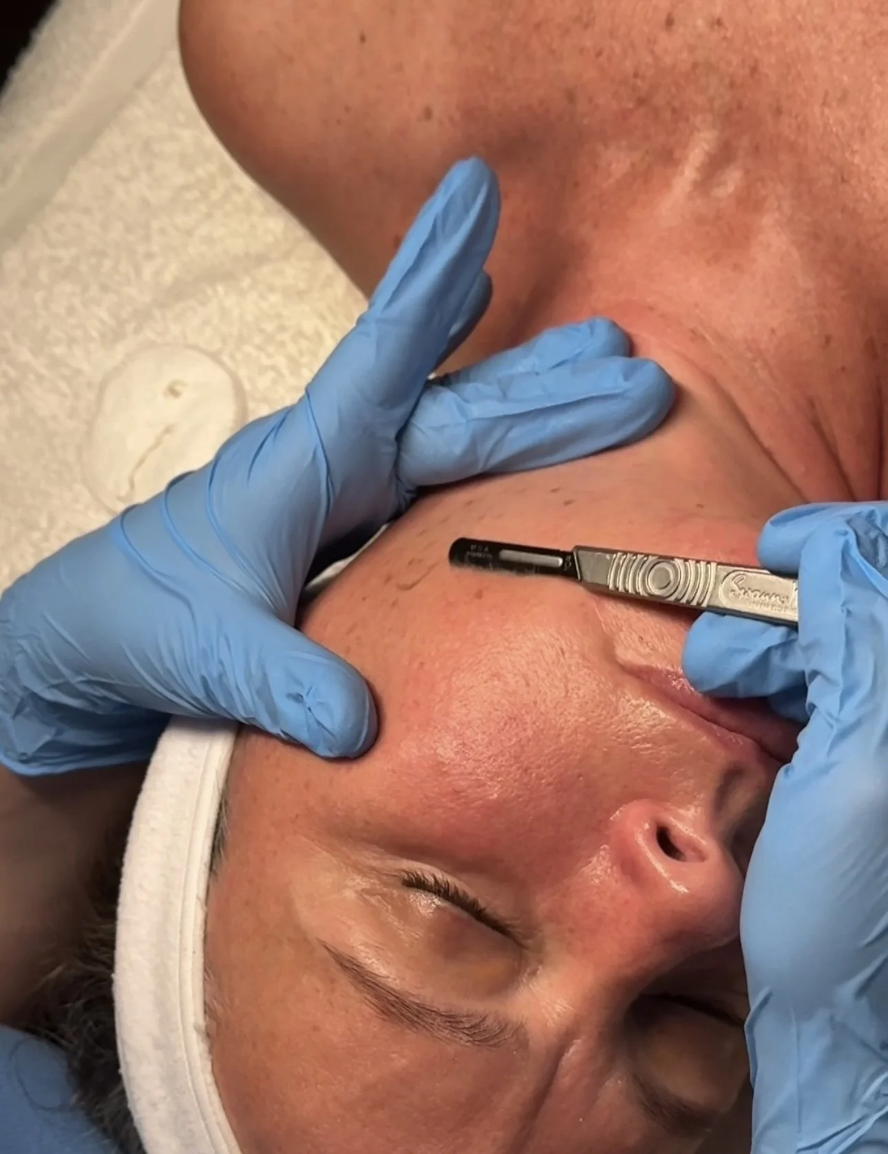 Dermaplane Glo image