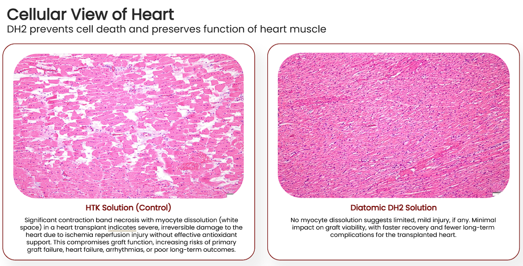 Histological images comparing myocardial tissue in HTK vs. DH2 preserved hearts