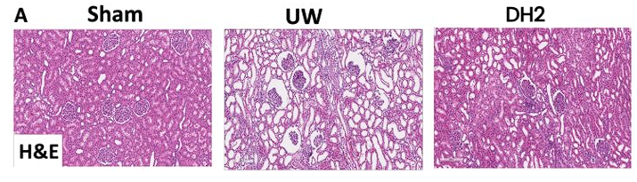 Histological images comparing kidney tissue in UW vs. DH2 preserved kidneys