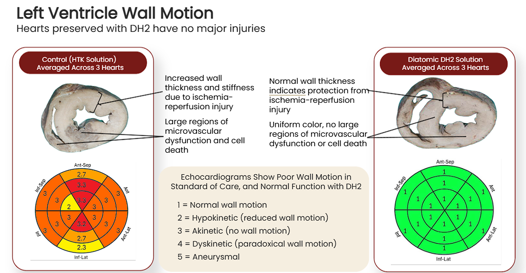 Echocardiographic images comparing wall motion in HTK vs. DH2 preserved hearts