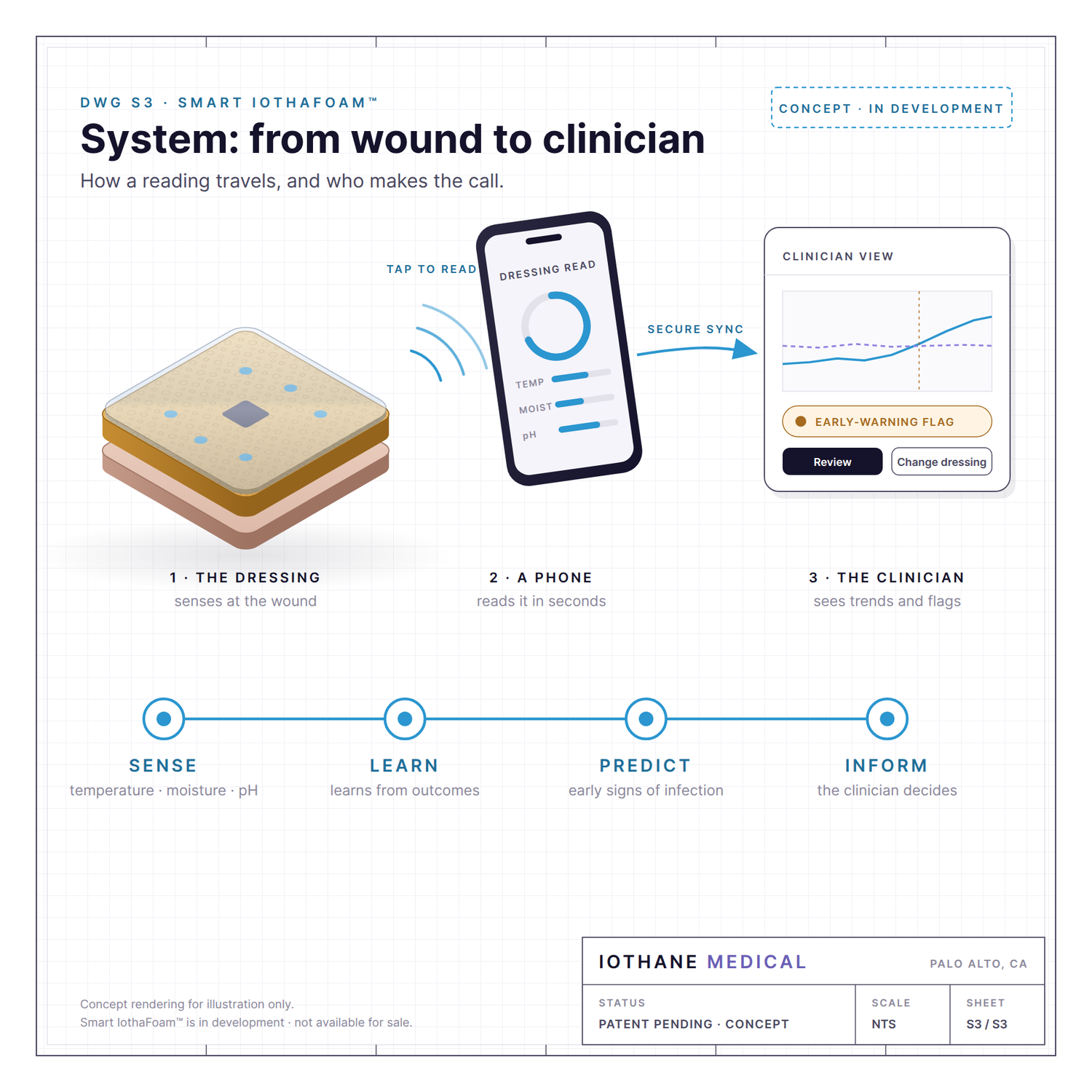 Concept drawing: Smart IothaFoam system, from the dressing to a phone to the clinician