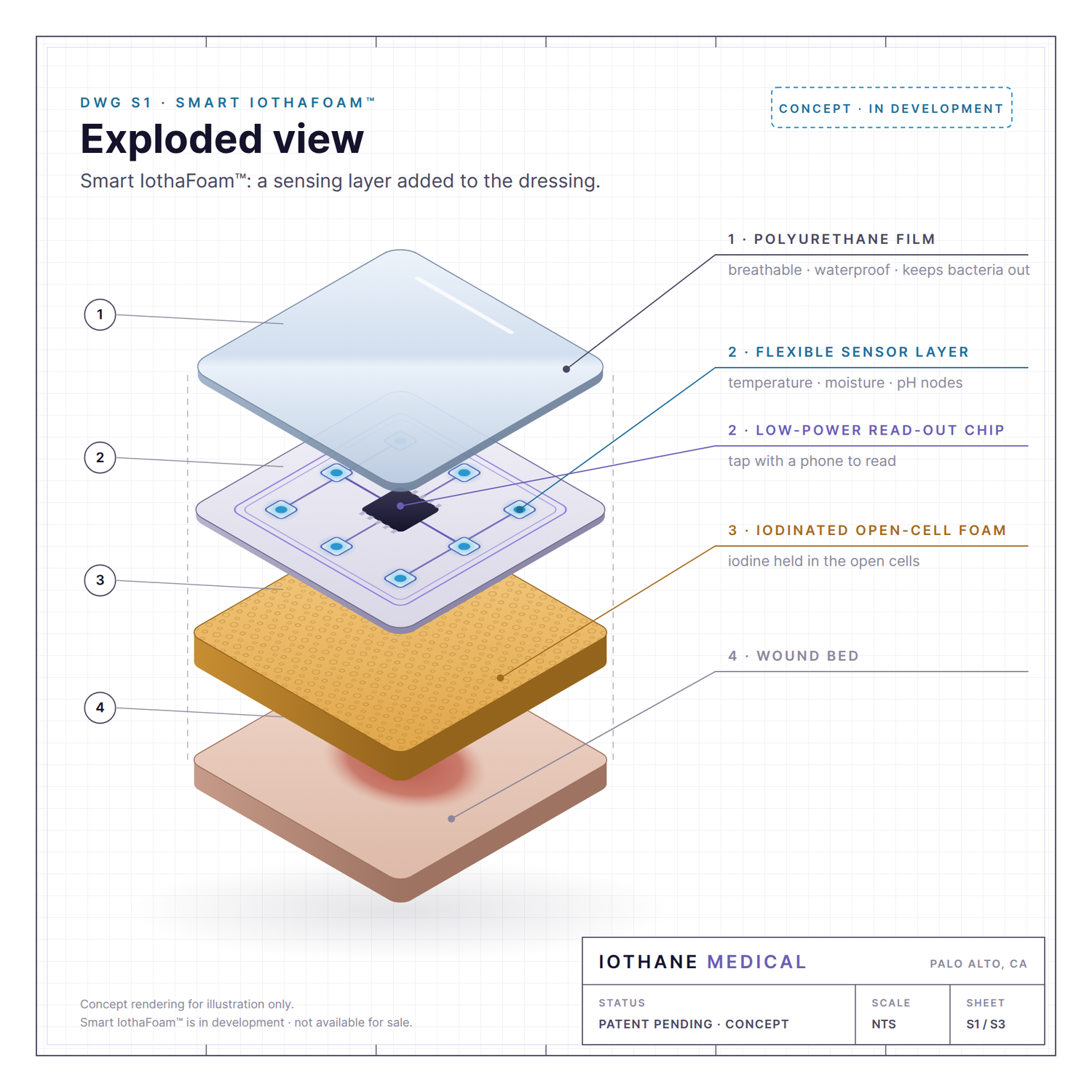Concept drawing: exploded view of Smart IothaFoam with a flexible sensor layer
