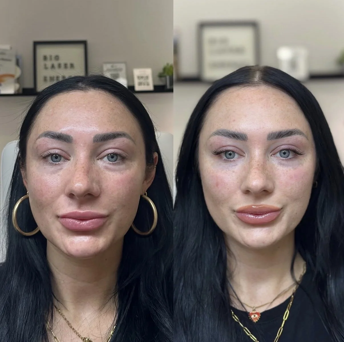 Anna treatment before-and-after comparison