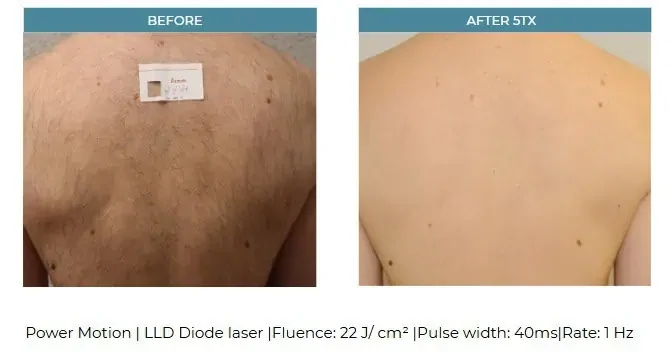 Slide 2