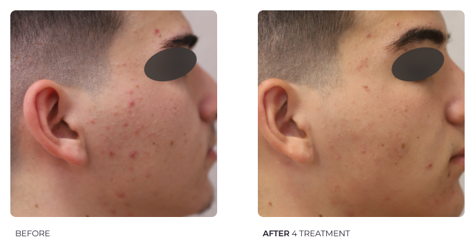 Slide 6
