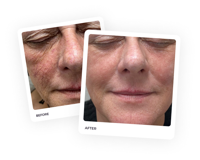 Slide 7