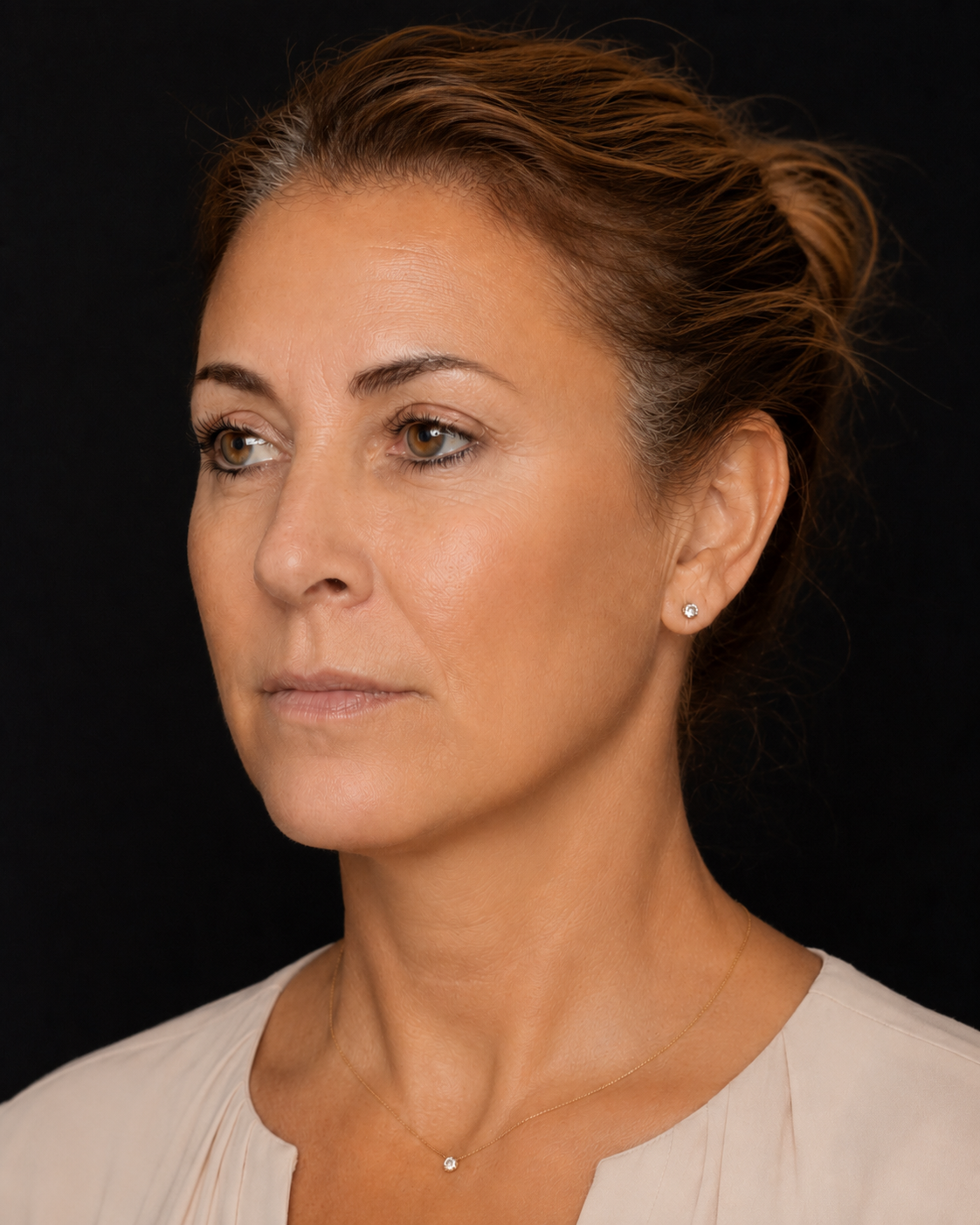 After facial biostimulation treatment