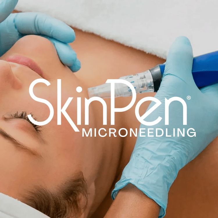 Close-up of SkinPen microneedling treatment on the cheek