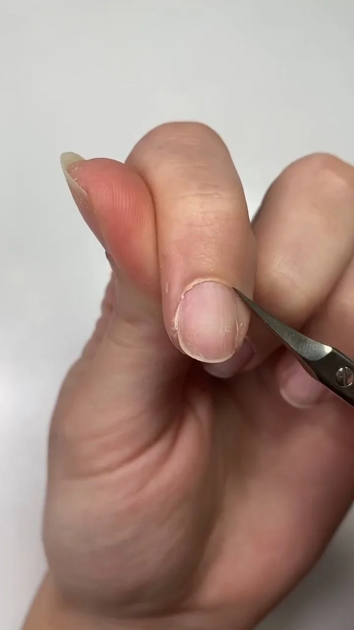 Trimming lifted cuticle using sterilized cuticle scissors