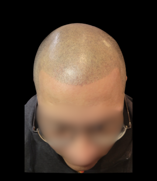 Before treatment result example 3