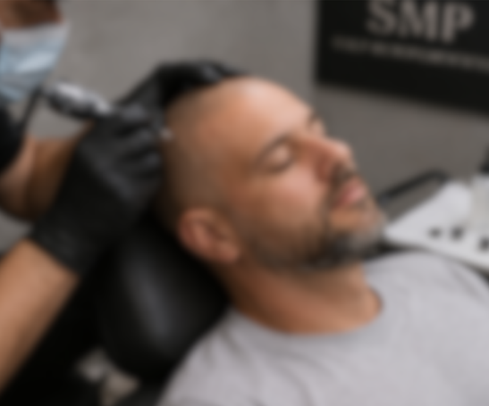 A man receives hairline and visual density treatment from a Subtle Return practitioner. 