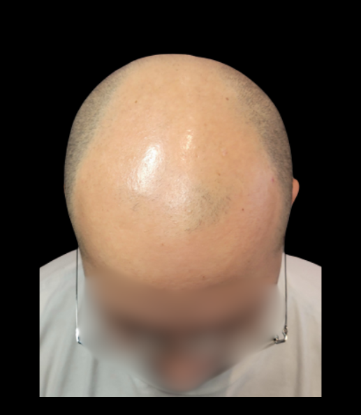 After treatment result example 3