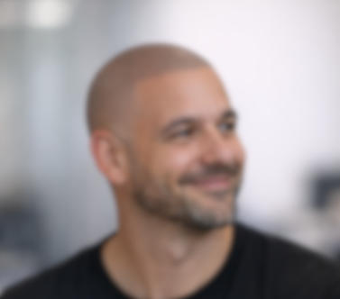 A man smiles for the camera after receiving hairline and visual density, satisfied with his restored look successful treatment of his hairloss.