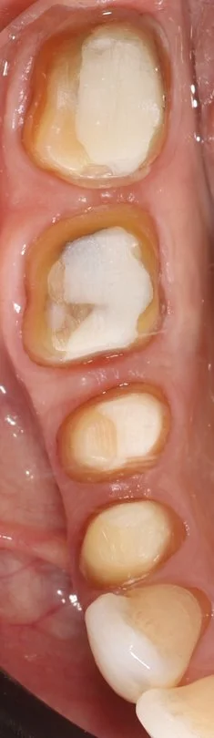 Step 5: Preparations