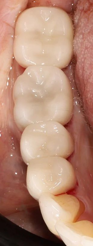 Step 7: Final result