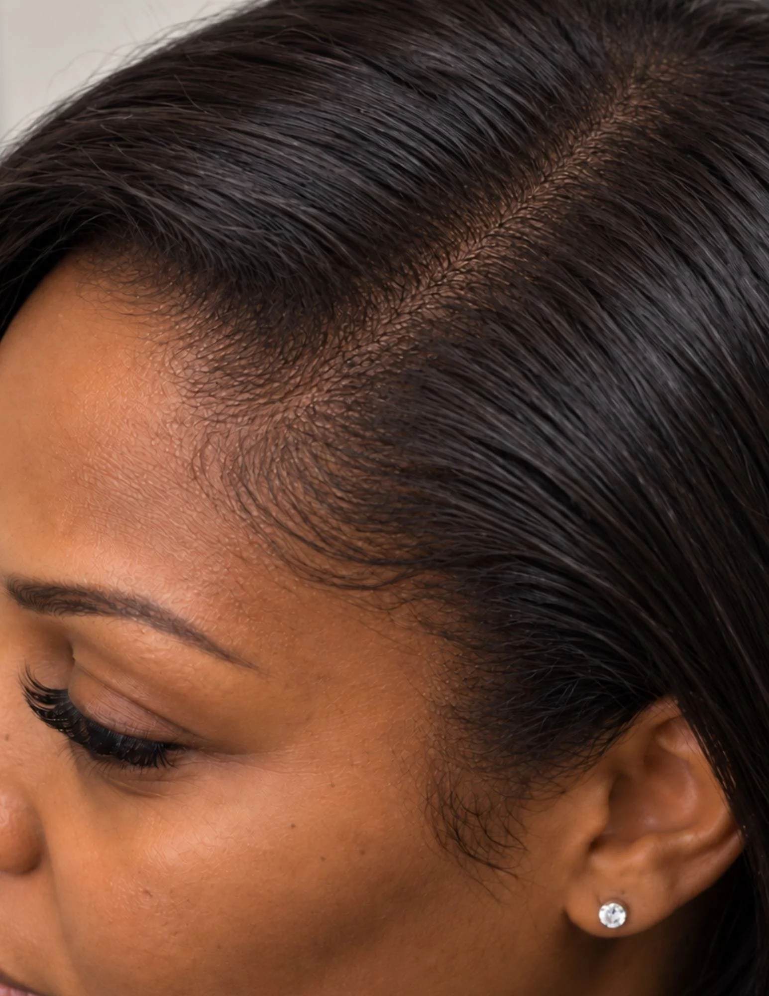 Scalp micropigmentation in Round Rock, TX at By Bautis Spa