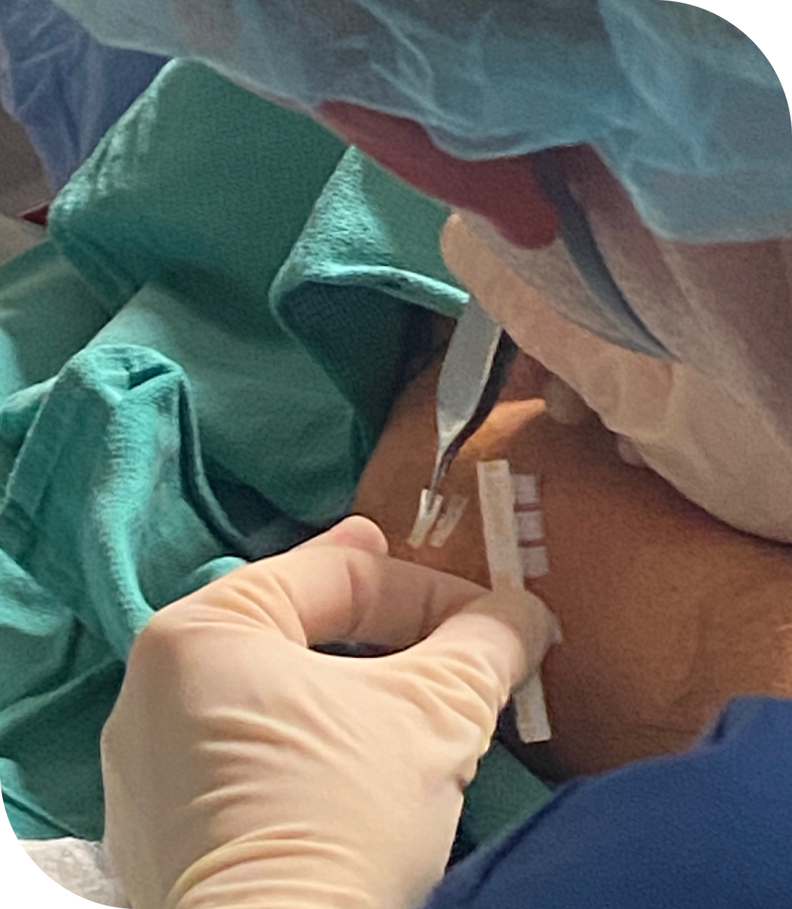 Expert Tendon Care Backed by Professional Experience