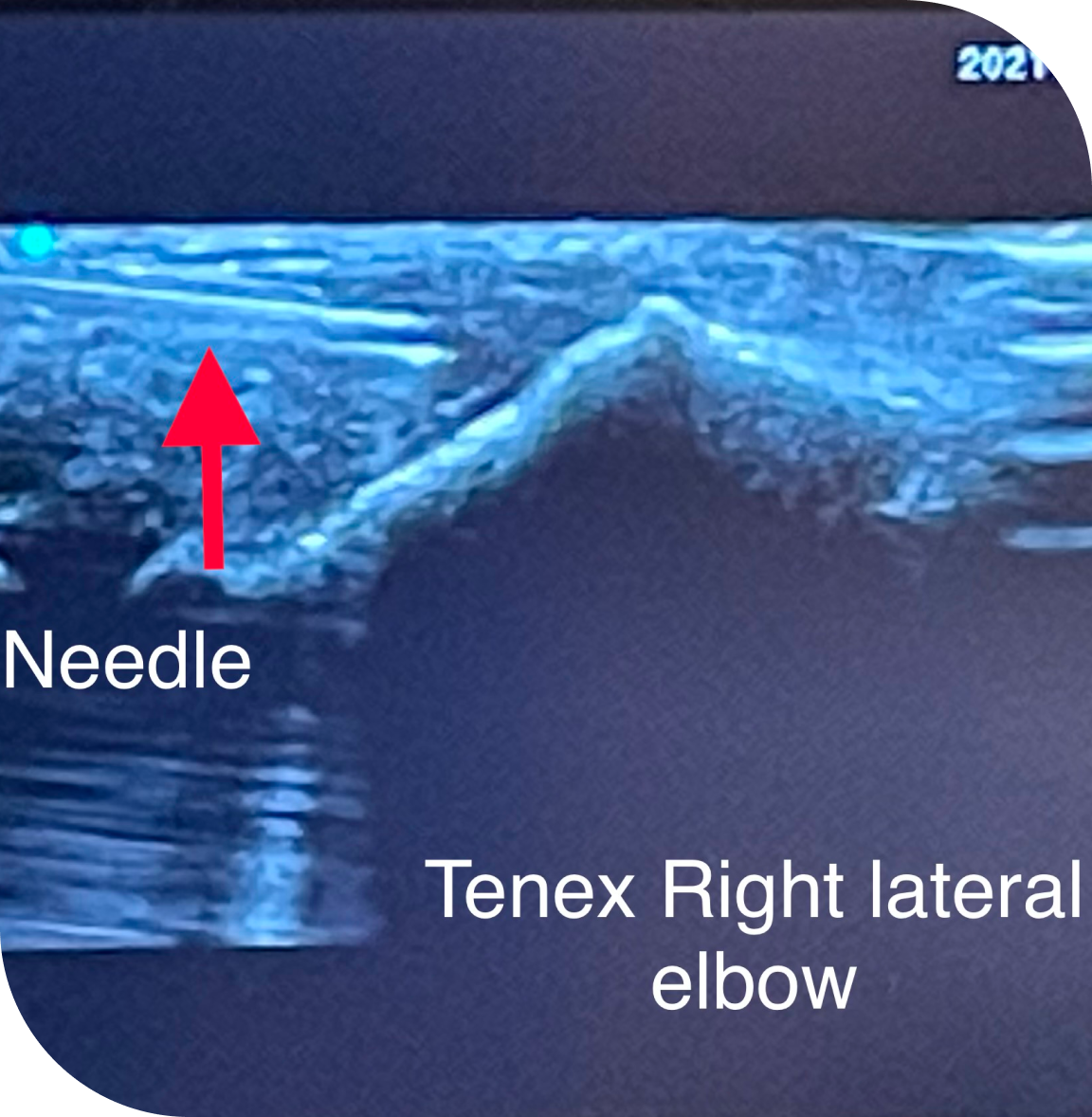 Over 20 Years of Experience in Musculoskeletal Imaging