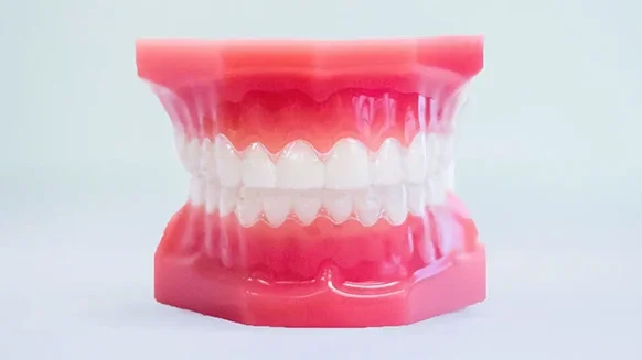 Invisalign clear aligners for teens and adults at Weiler Orthodontics Harrisonburg VA