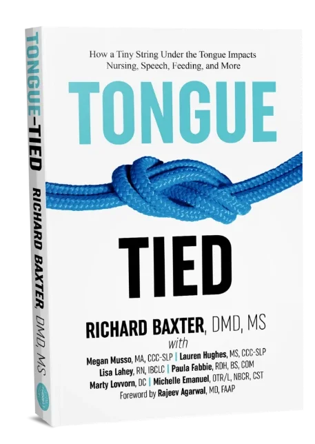 Tongue Tied