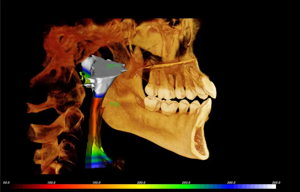 i-CAT CBCT Imaging