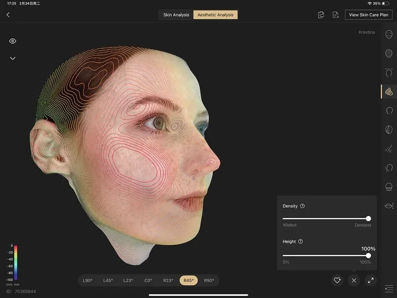 Análisis del contorno facial