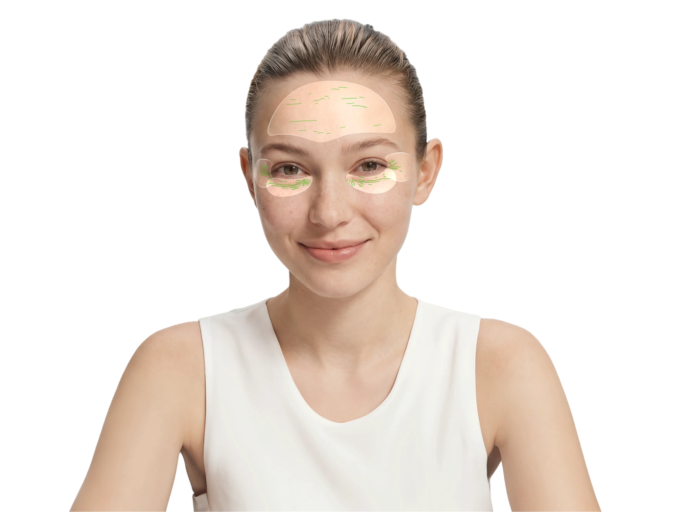 AI aging analysis of a face: forehead lines, periorbital wrinkles, crow's feet