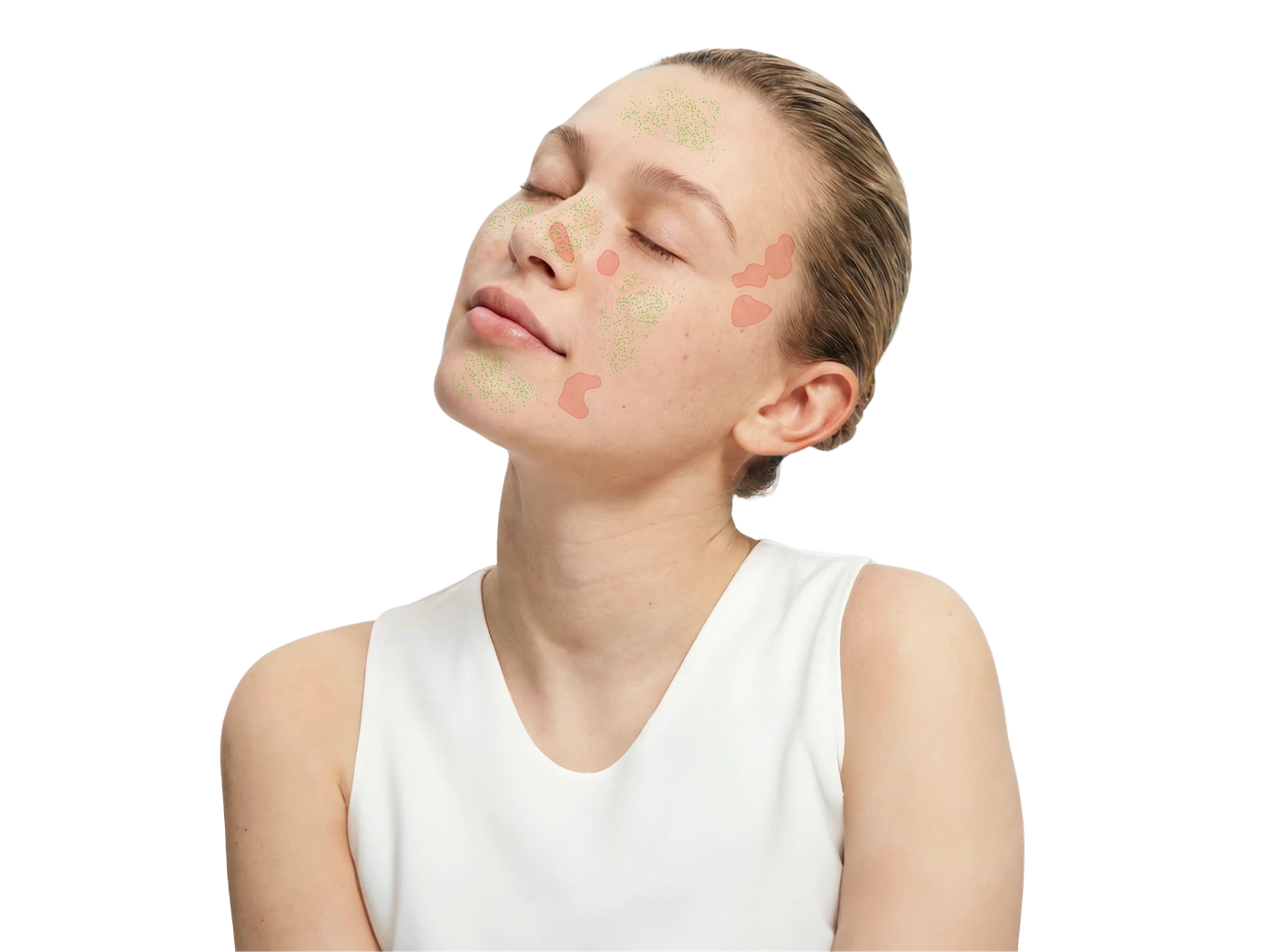 AI skin analysis of a face: spots, dark circles, pores, redness