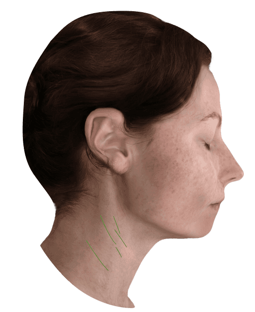 Análisis de arrugas en el cuello de Eve Muse