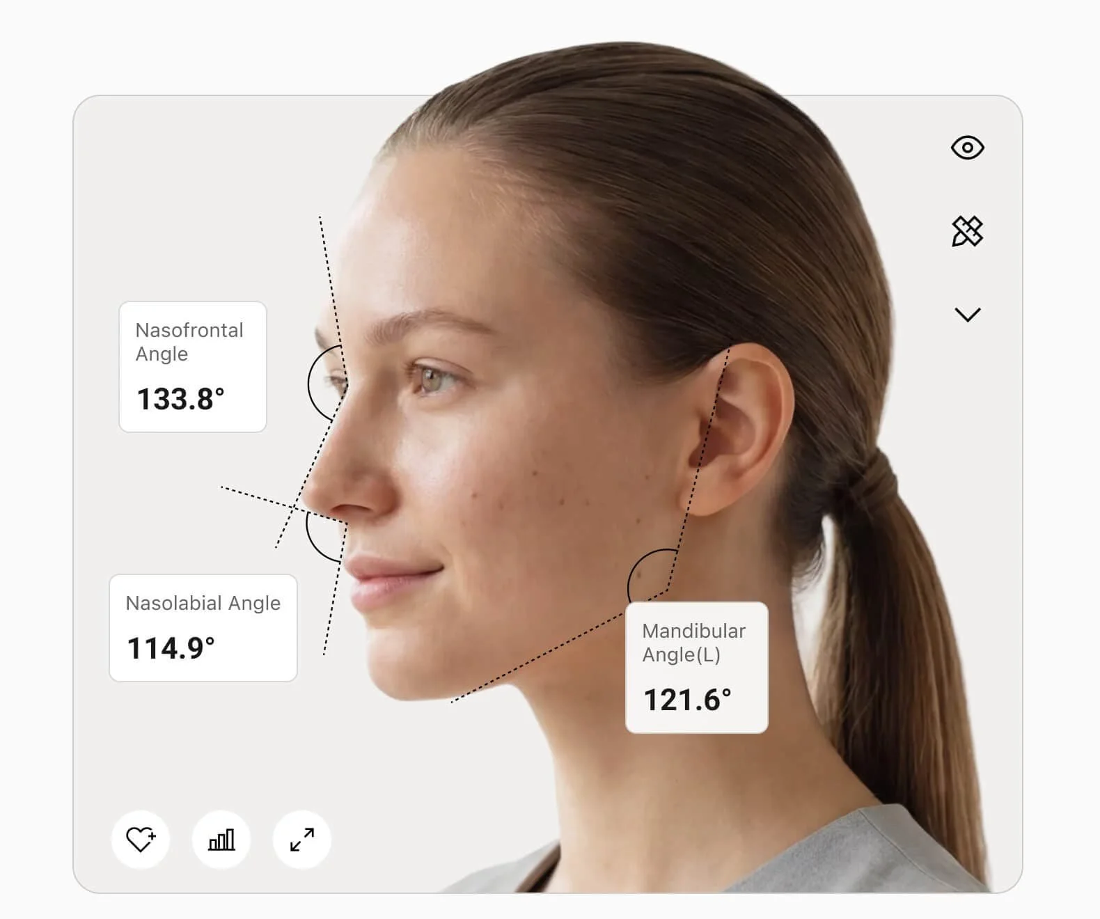 Eve Muse facial aesthetic analysis with angle measurements