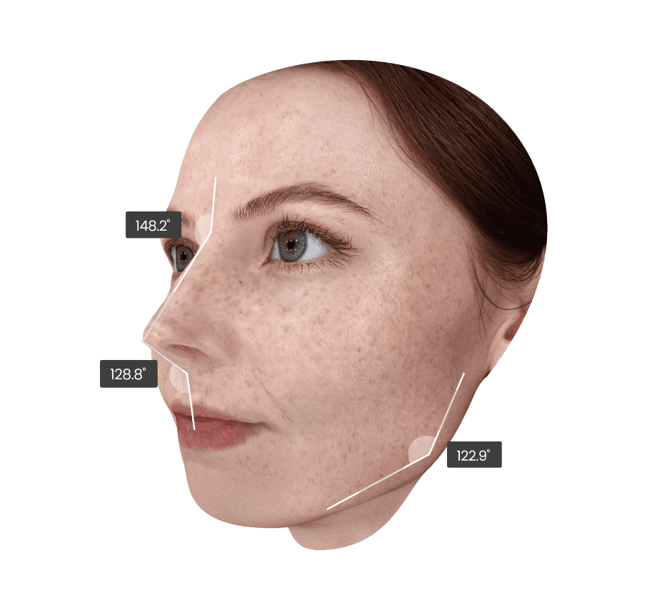 Análisis de ángulo del perfil de Eve Muse