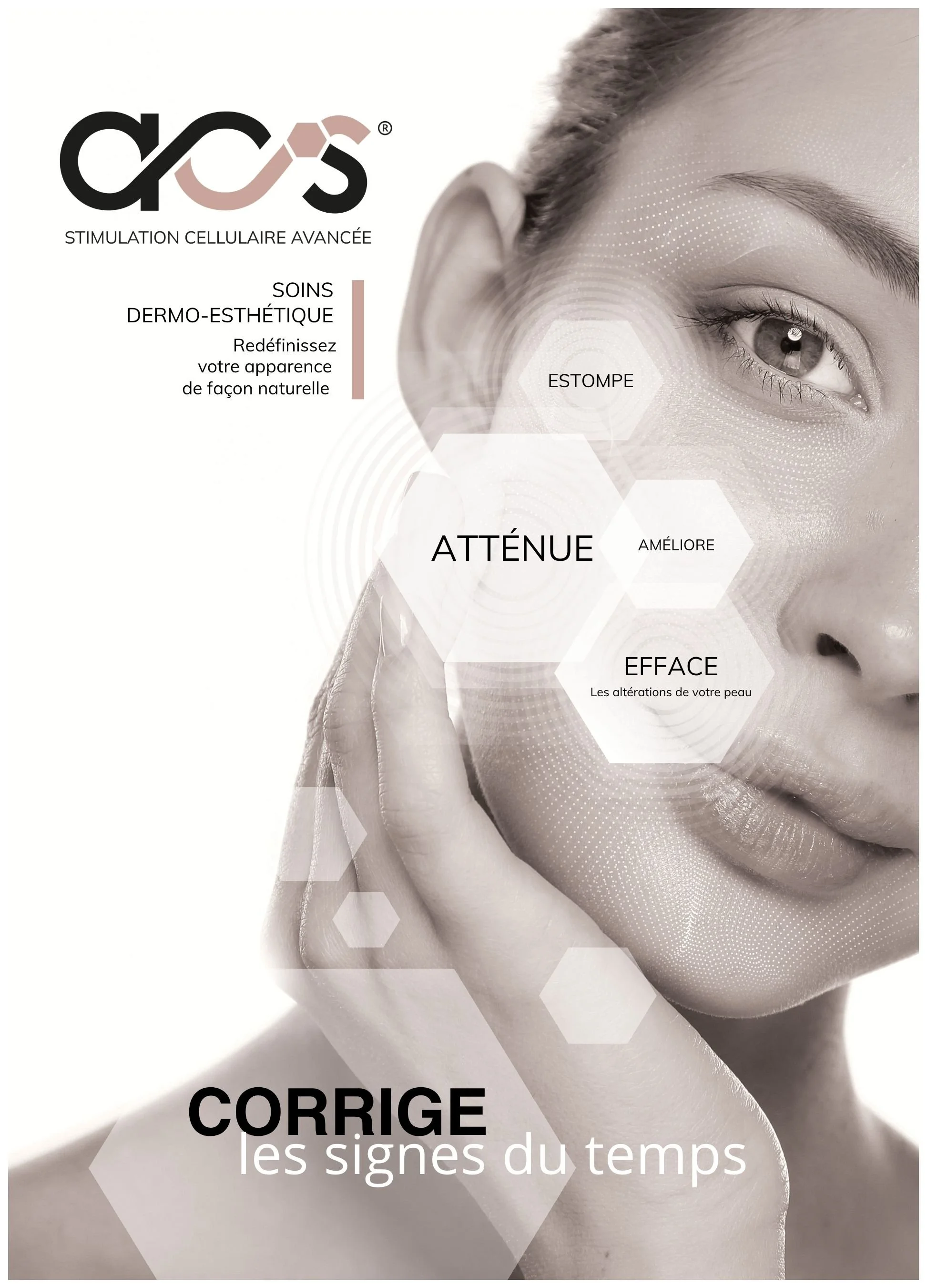 Stimulation Cellulaire Avancée ACS SkinNeedler — L'Institut d'Alice, Conflans-Sainte-Honorine