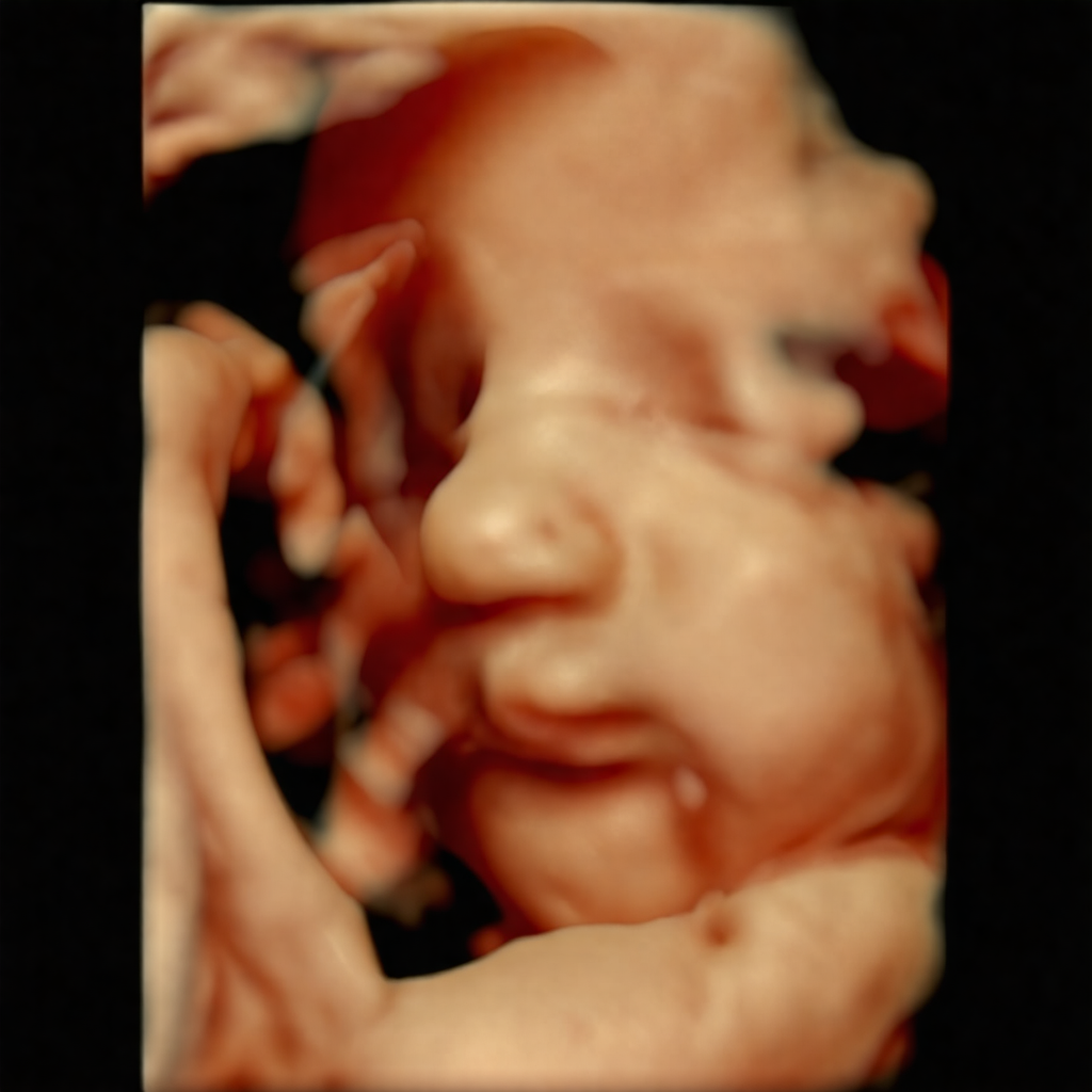 Original 3D ultrasound showing the baby’s face