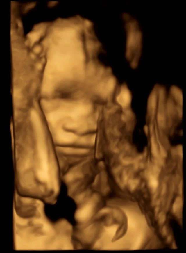 Original ultrasound with a soft view and a hand near the baby’s face