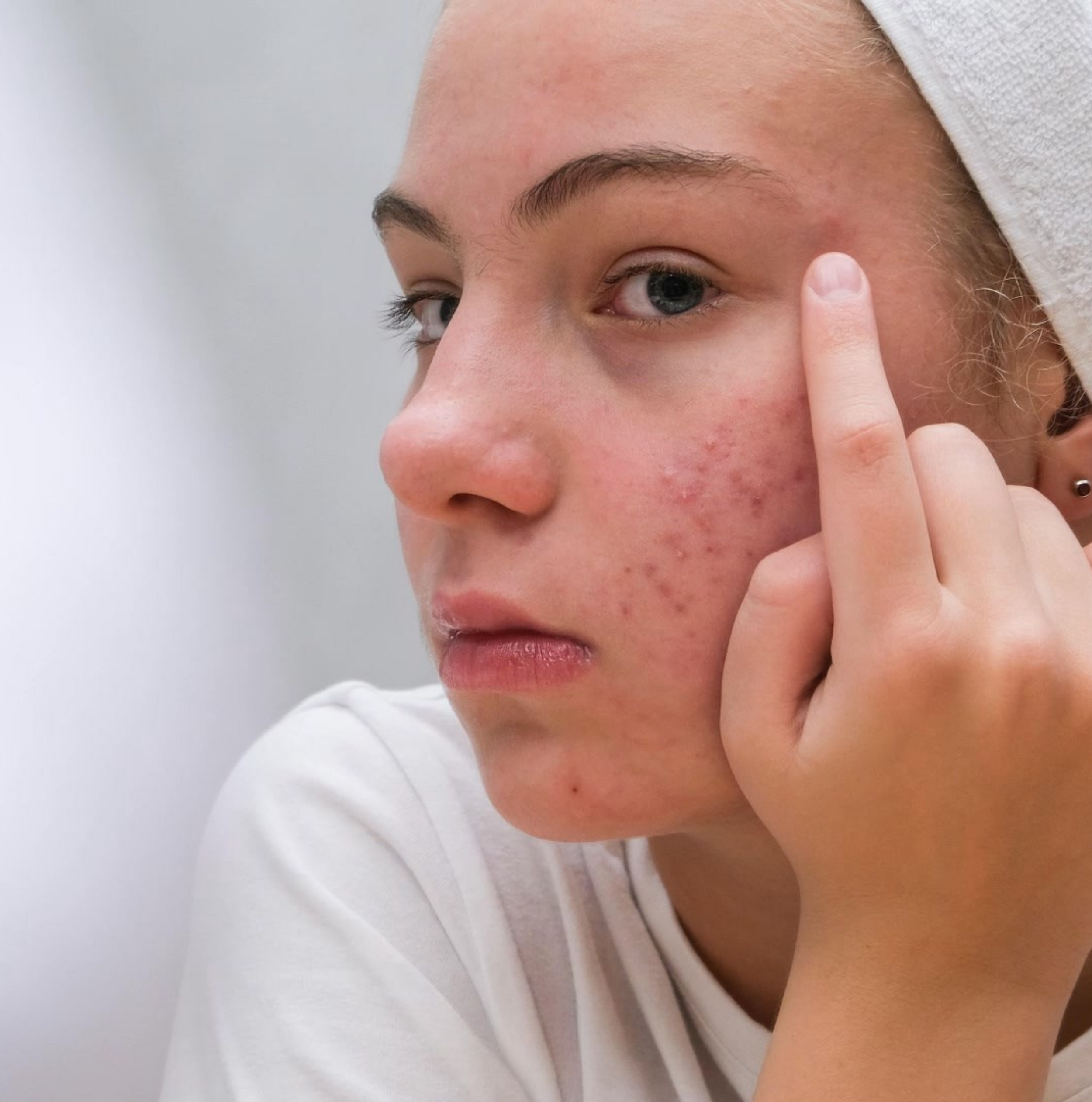 Dermatology consultation