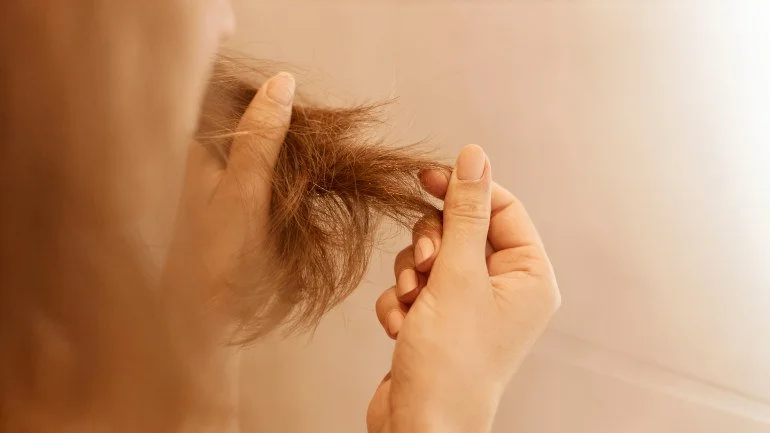 Femme qui observe ses cheveux fragilisés — chute post-partum