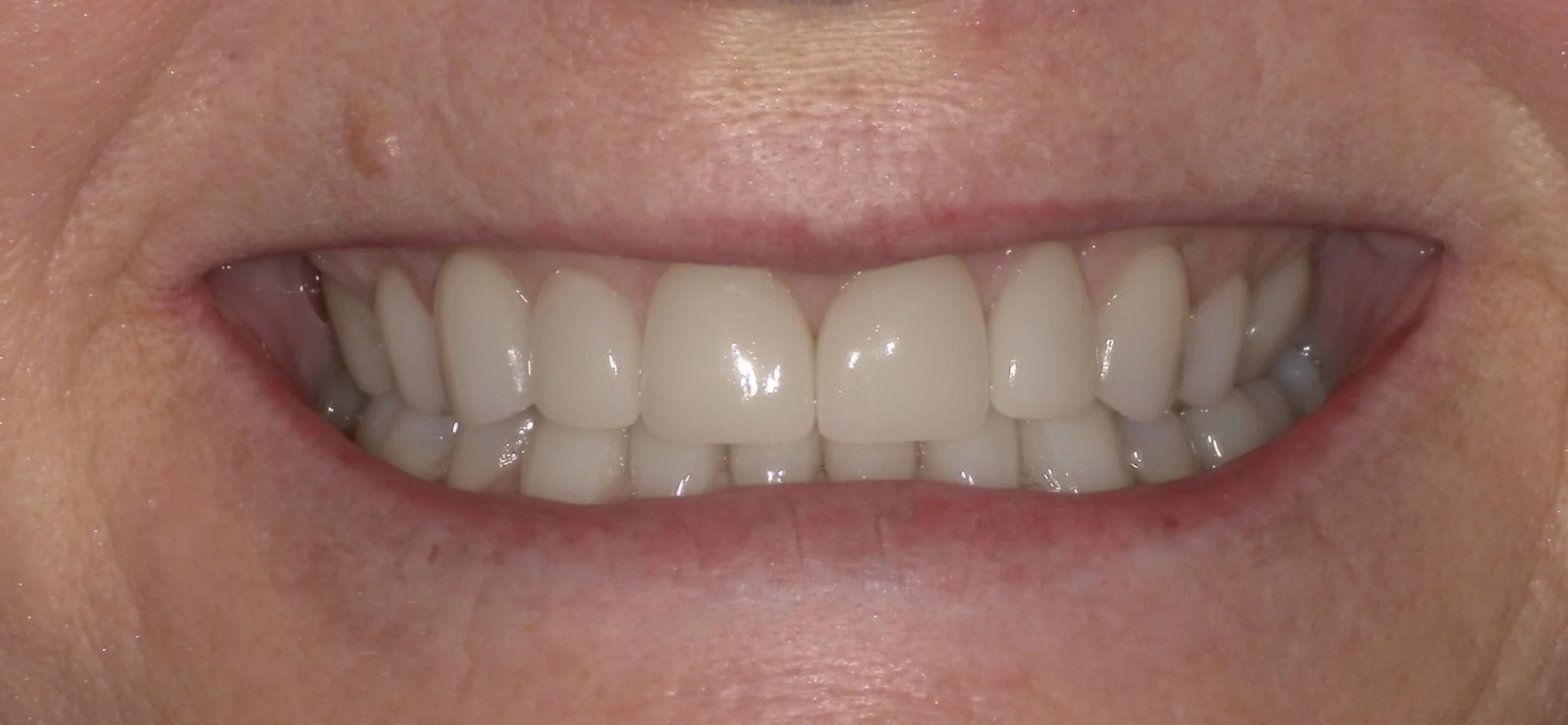 Before image