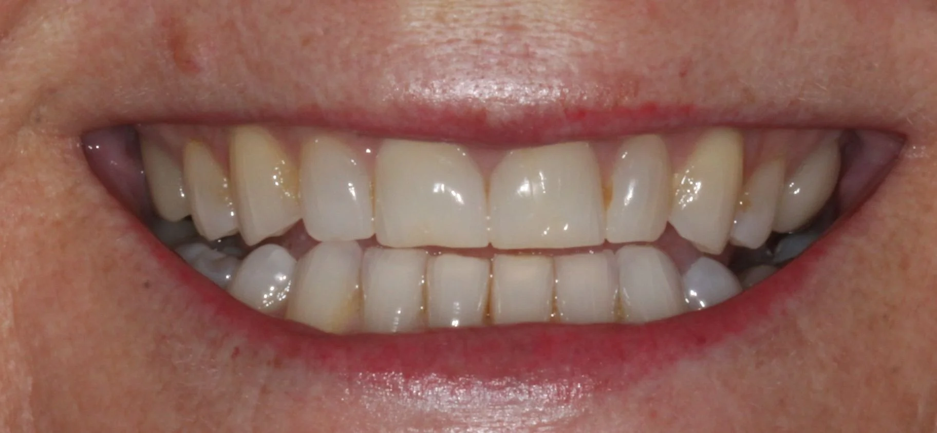 After image
