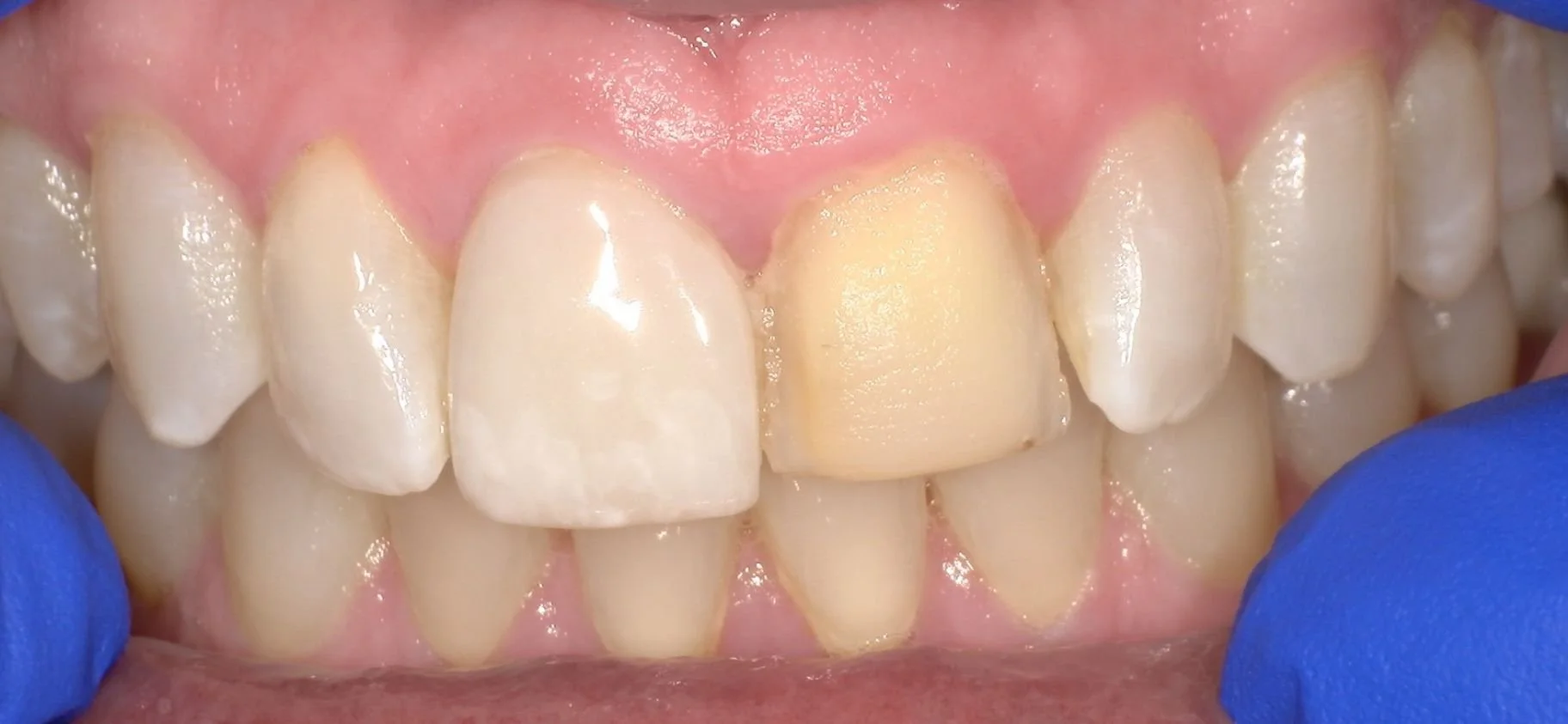 After image