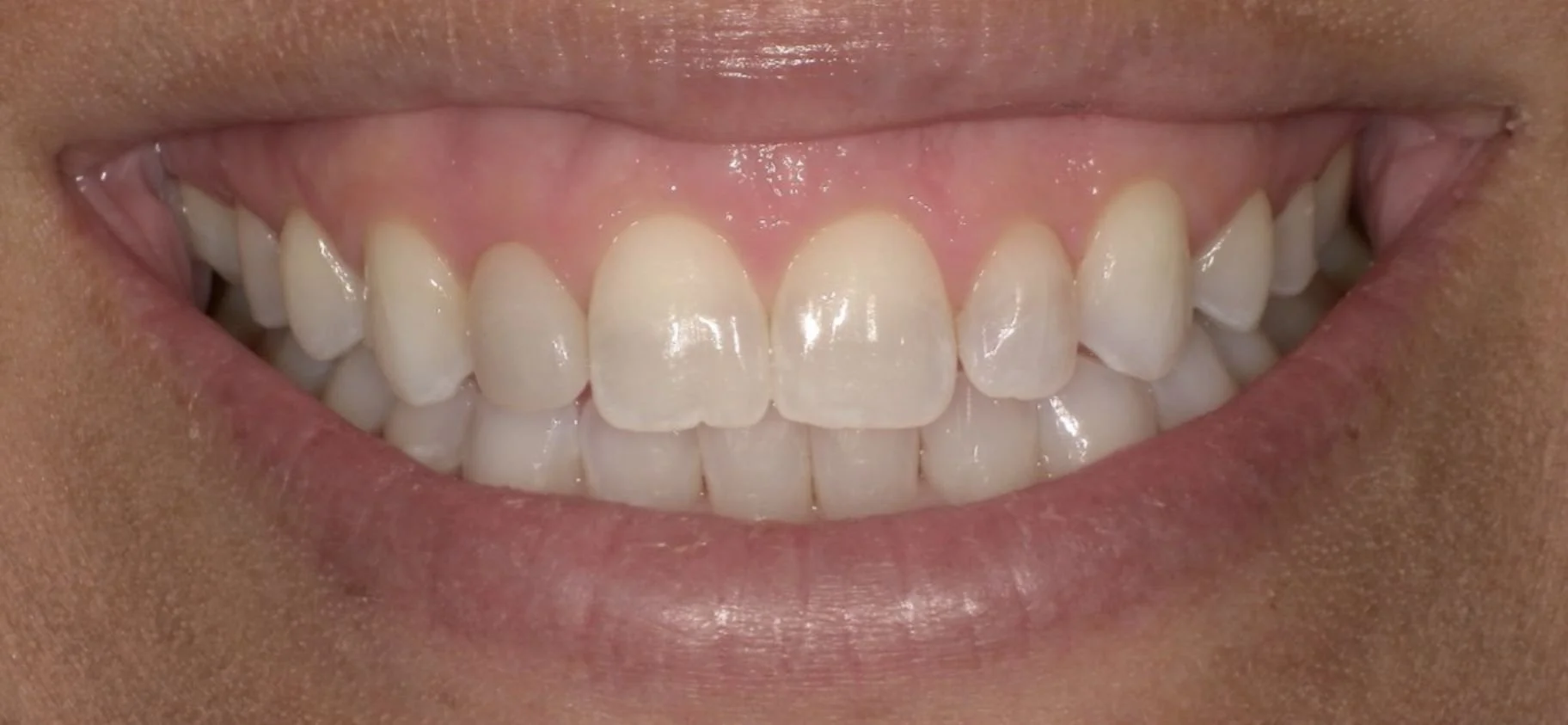Before image