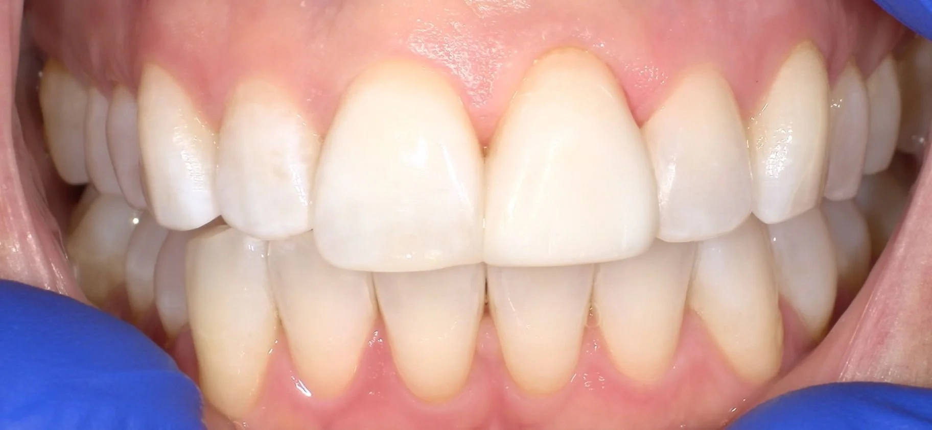 Before image