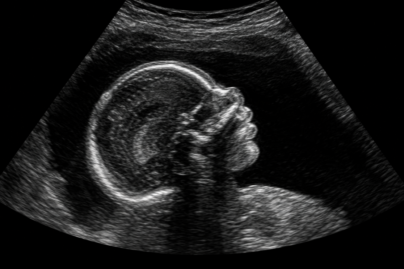 Illustrative grayscale ultrasound showing a fetal profile
